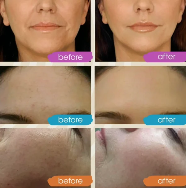 Retinol Face Serum with HA (Pack)