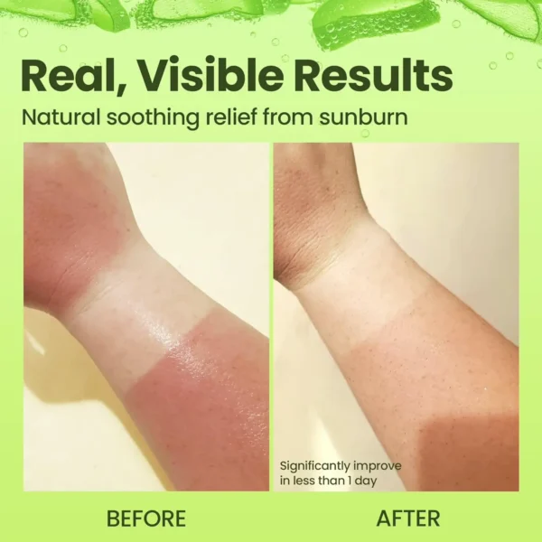 Natural Aloe Vera by Nature - Hydration & Sunburn Care