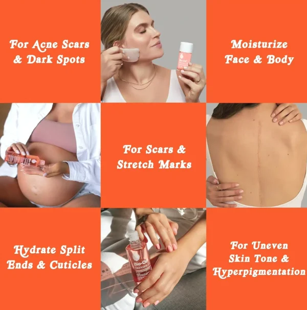 Bio-Oil Body Oil, Vit E Treatment for Scars & Stretch Marks, Dermatologist Recommended, All Skin Types, 6.7 Ounces