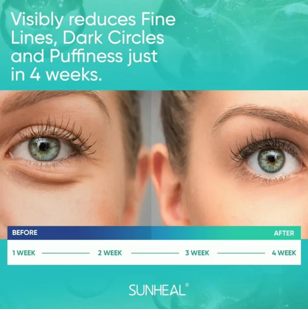 Retinol Eye Treatment for Dark Circles & Puffiness
