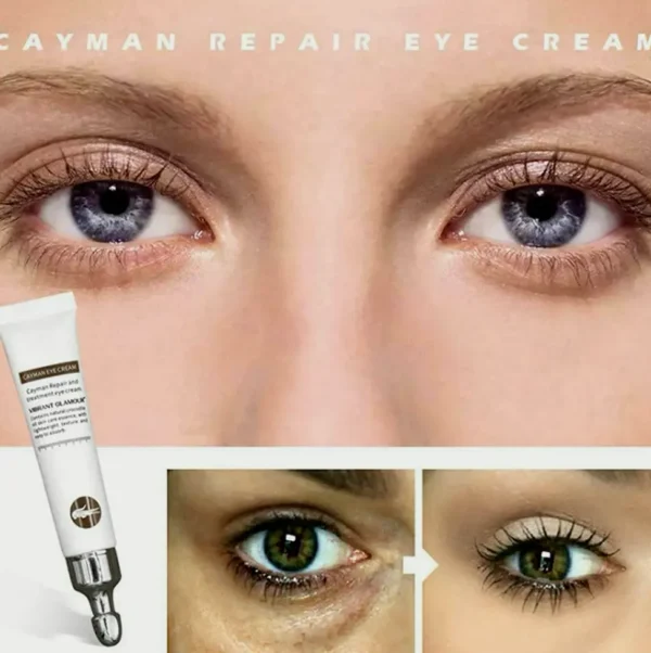 Anti-Aging Cayman Eye Cream, Reduces Crows Feet